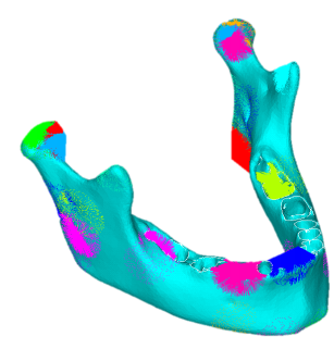 Finite element model of mandibular